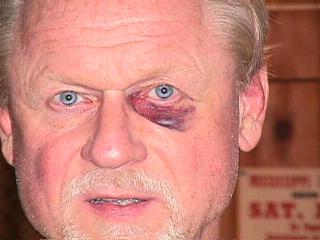 Black Eye.jpg (13480 bytes)